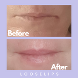 The Looselips Lip Lifter