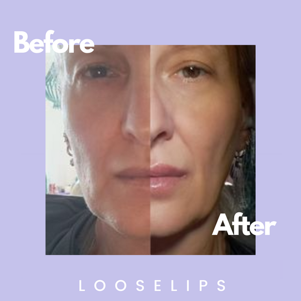Before and after photo of looselips lip lifter V vegan lip plumper