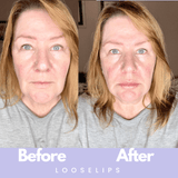 The Looselips Lip Lifter