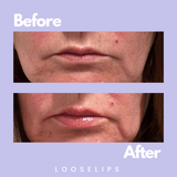 LIP LIFTER V (vegan)